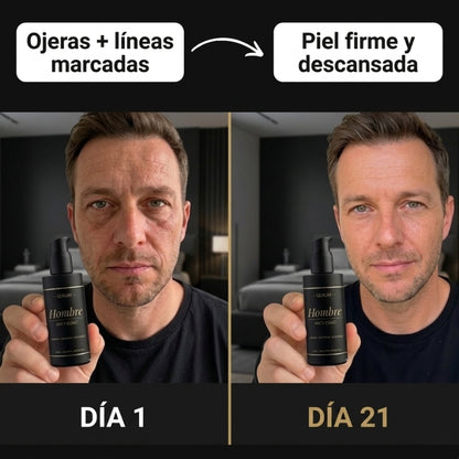 SERUM ANTI-EDAD: Recuperá tu mejor Aspecto Facial En 21 días.