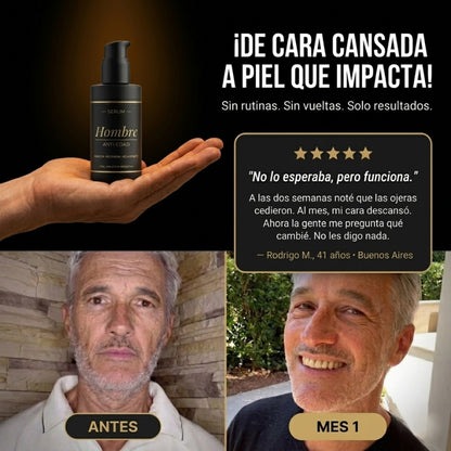 SERUM ANTI-EDAD: Recuperá tu mejor Aspecto Facial En 21 días.