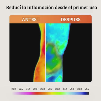 Alivio natural para dolor de rodilla y molestias articulares.